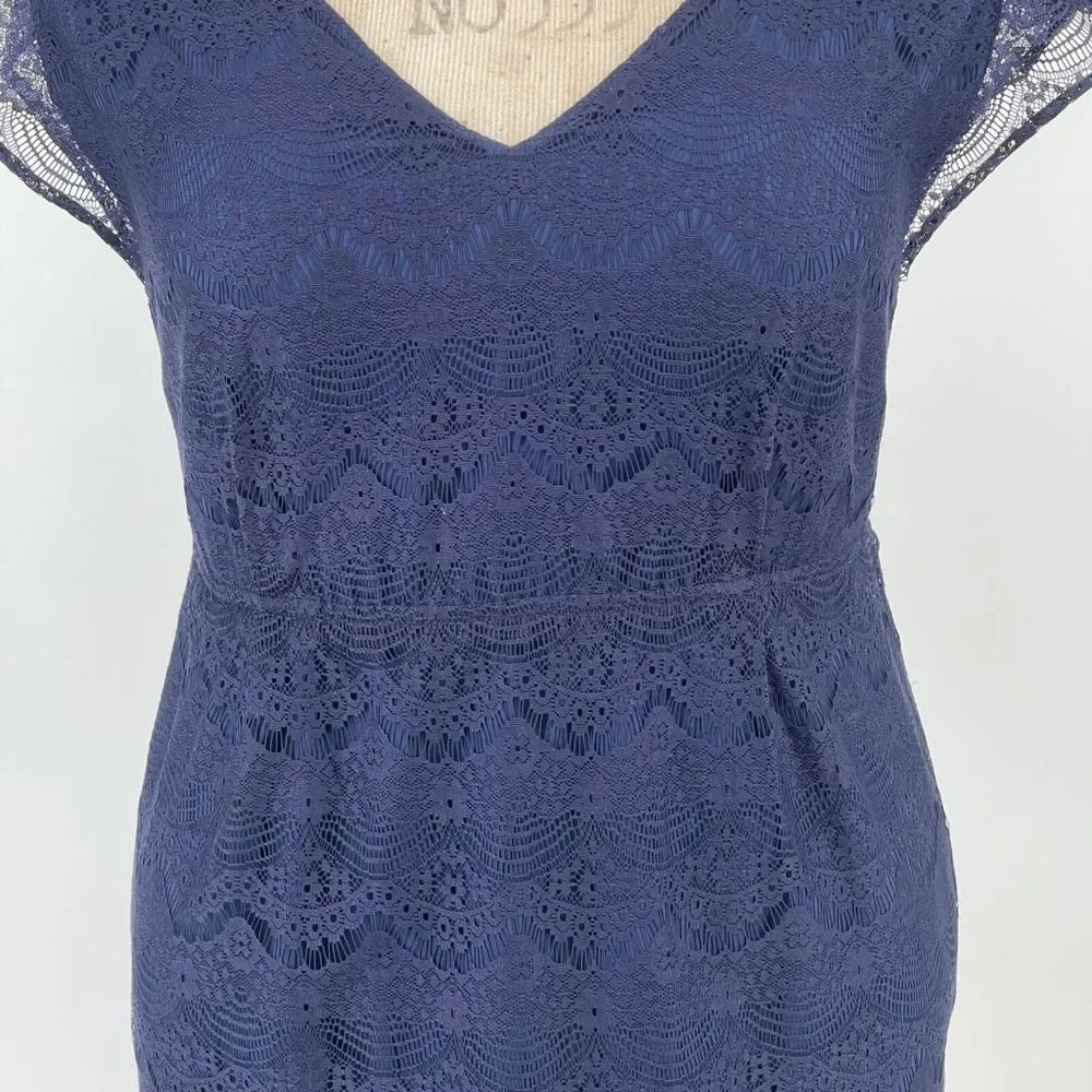 Fossil Penny Lace Dress M Bohemian Cap Sleeve V-Neck Elastic Waist Scallop Navy - Picture 3 of 11